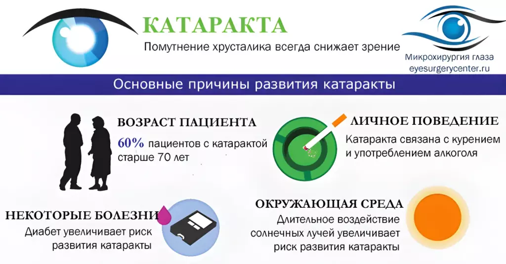 Основные причины развития катаракты Основные причины развития катаракты