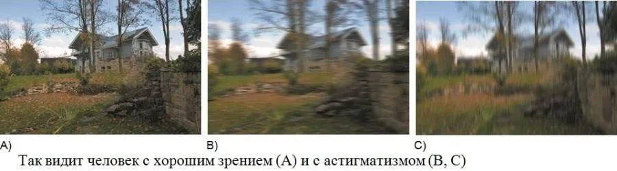 Как видит человек с хорошим зрением и астигматизмом Как видит человек