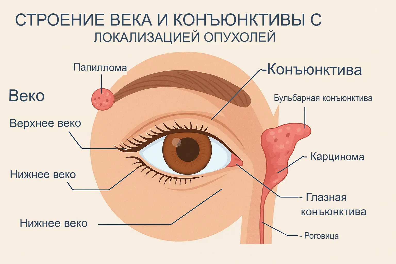 Строение века и конъюнктивы с локализацией опухолей Строение века и конъюнктивы с локализацией опухолей